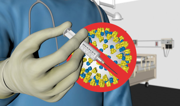 Measles -Vaccination