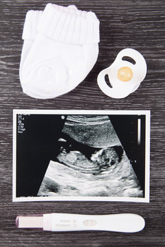 Ultrasound Photo, Pregnancy Test  and baby socks