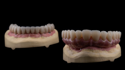 dental implants on a black background