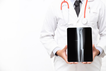 doctor holding tablet computer with x ray film