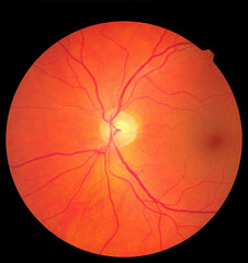 Ophthalmic image detailing the retina and optic nerve inside a healthy human eye. Medicine concept