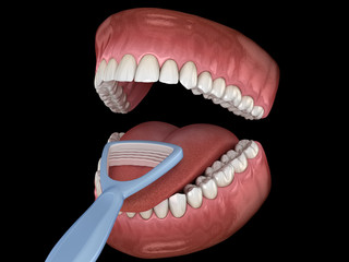 Tongue cleaning - Scraper. Medically accurate 3D illustration of oral hygiene.