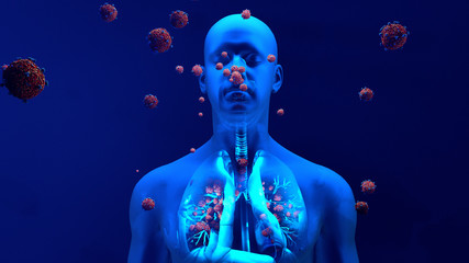 Droplets infected with a virus spray into the air, Human lungs infected by the Coronavirus or by virus, Respiratory infection caused by a virus. SARS
