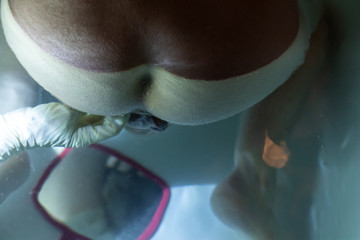A top down view as a woman gives birth underwater, hands of doctor use mirror as child head emerges...