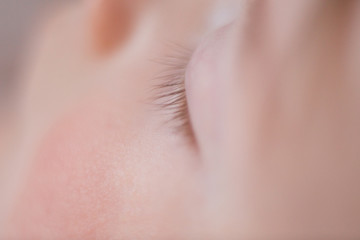 baby's face delicate skin