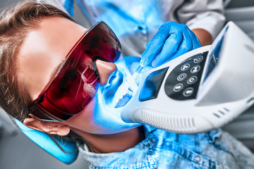 Girl patient in the dental clinic. Teeth whitening UV lamp with photopolymer composition.