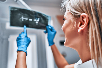 Female dentist examining x-ray at the dental clinic