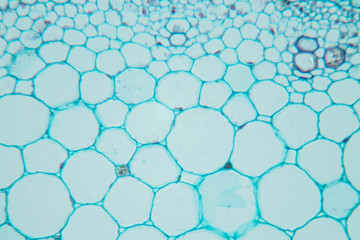  Close up Plant Stem under the microscope for classroom education.