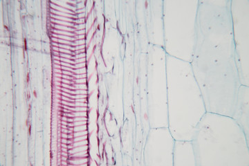  Close up Plant Stem under the microscope for classroom education.