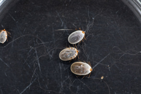 Close up Dog ticks and Flea under microscope for study in laboratory.