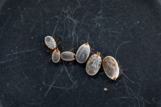 Close up Dog ticks and Flea under microscope for study in laboratory.