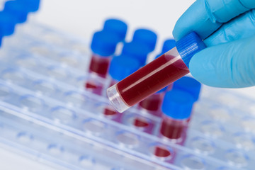 getting one of some blood samples in a tube rack