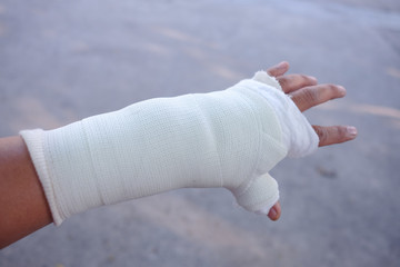 The injured man's hand and a splint.