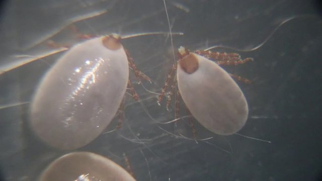 Close up Dog ticks and Flea under microscope for study in laboratory.