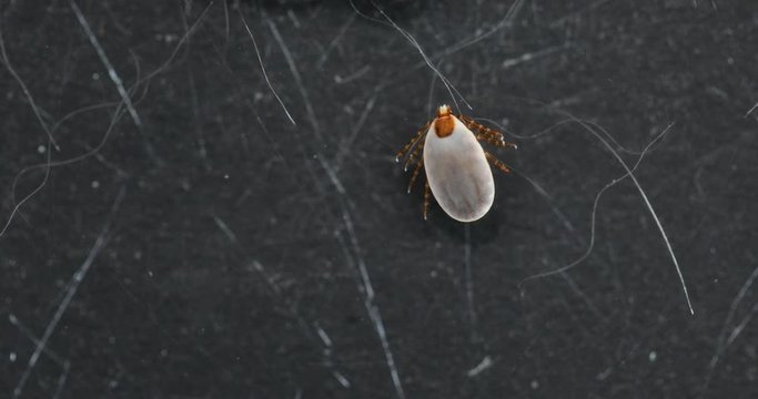 Close up Dog ticks and Flea under microscope for study in laboratory.