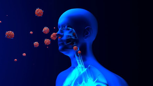 Droplets infected with a virus spray into the air, Human lungs infected by the Coronavirus or by virus, Respiratory infection caused by a virus. SARS