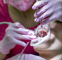 Dental examination. Patient with braces and cheek retractor