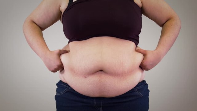 Close-up of unrecognizable Caucasian woman's tummy. Obese adult woman shaking fat on belly. Overweight, obesity, unhealthy lifestyle.