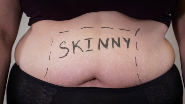 Close-up of female Caucasian tummy with Skinny word written. Belly of obese young woman. Overweight, obesity.