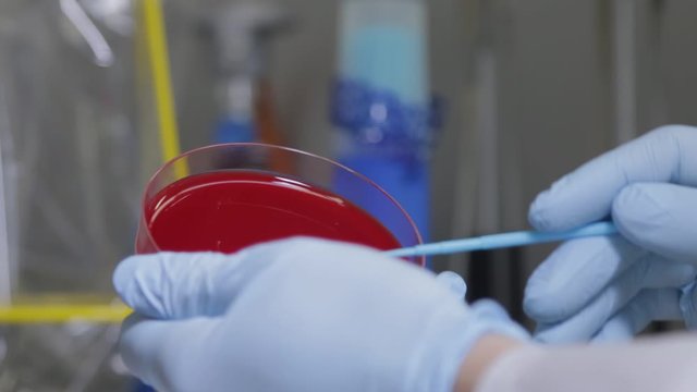 Blutprobe Corona Virus SaRS Schweinegrippe Vogelgrippe