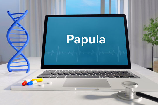 Papula &ndash; Medizin/Gesundheit. Computer im B&uuml;ro mit Begriff auf dem Bildschirm. Arzt/Gesundheitswesen