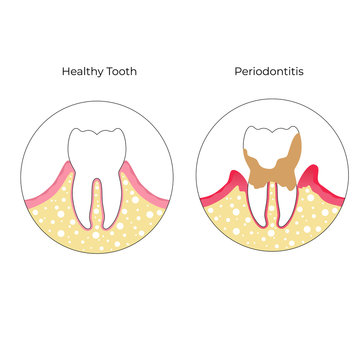 Vector isolated illustration of tooth 