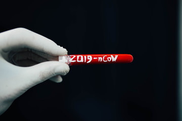 epidemic test and blood  in the doctor’s hand  coronavirus test tube 2019 - nCoV, appeared in Wuhan, China