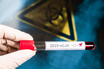 Naklejka premium The doctor holds a test tube with blood in his hand. A positive blood test for a new coronavirus. Against the background of an X-ray of a patient with pneumonia and a biohazard sign