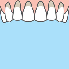 Blank banner Upper Recession gums illustration vector on blue background. Dental concept.