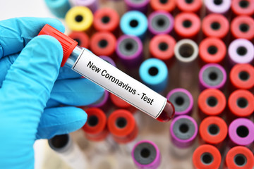 Obraz premium Blood sample tube for new coronavirus test, novel coronavirus 2019 found in Wuhan, China