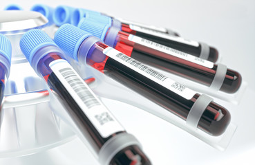Blood tubes in the centrifuge. Concept image of blood tests, diseases and genetic and laboratory research.