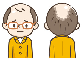 薄毛に悲しむ男性