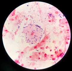 Gram positive bacilli on red background.