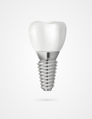 vector tooth implant 3d illustration - 319797744