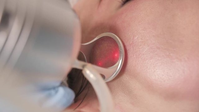 Resurfacing facial skin with a laser. Modern innovative medical equipment. laser face polishing in a cosmetology or plastic surgery clinic.