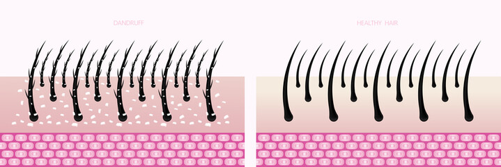 Hair problem and hair protect and care technology concept vector illustration.