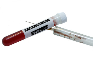 Coronavirus blood test tube and blood sample on white background
