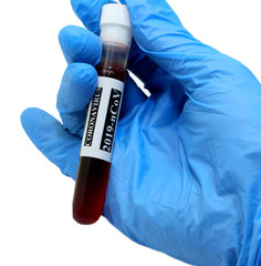 test tube for blood tests of Coronavirus