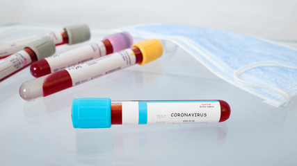 positive coronavirus blood tubes and mask