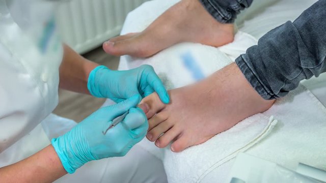 Pedicure technicians wears gloves and removes excess cuticle and excess skin