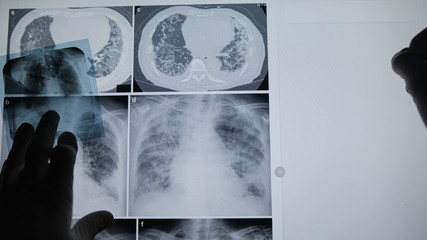 Professional medical team examining a patient's radiography