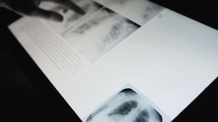 Doctor checking on chest X-ray. Man holding radiography looking at it.