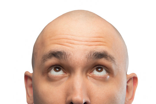 Image of bald man looking up, half head