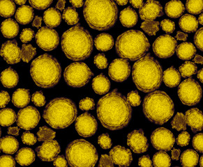 detail of ultraestructure of deadly coronavirus particles under transmission electron microscopy...