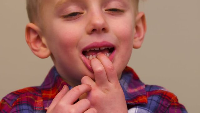 Cute little boy showing off his loose and missing baby teeth.