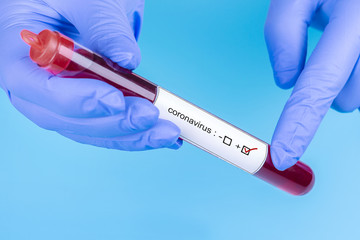 Obraz premium Coronavirus. Doctor's hand in a medical glove. Blood sample in vitro for analysis.The medecine. Analyzes. Viruses.