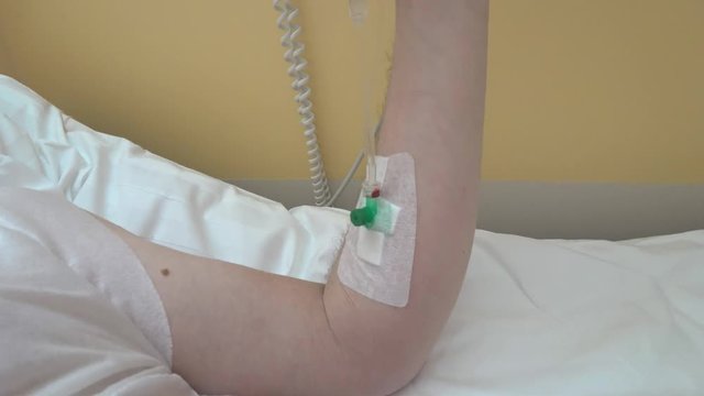 A Detail view of a venous catheter mounted on the patients arm. Pacint raises his hand looking at the device, the camera moves along the hand snatching the details.