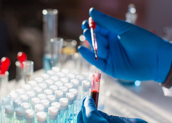 Researcher in a protective gloves in the laboratory working on a vaccine against the virus. Drop of...