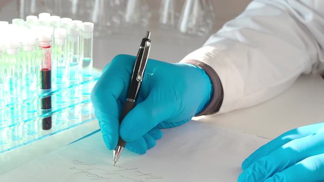 Hands of a doctor in a lab. Making a notes in researching anti-virus vaccine.
