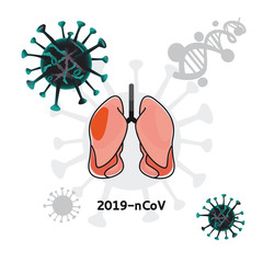 Virus epidemic Coronavirus. Coronavirus pneumonia illustration